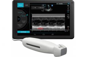 УЗИ аппарат Sonosite iViz